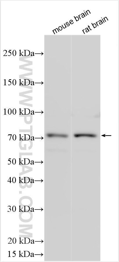ACSL6 Antibody in Western Blot (WB)
