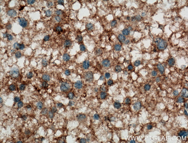 NCAM2 Antibody in Immunohistochemistry (Paraffin) (IHC (P))