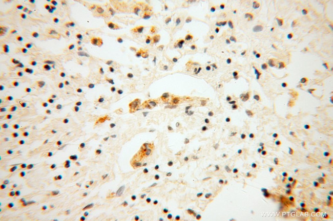 DNAJC4 Antibody in Immunohistochemistry (Paraffin) (IHC (P))