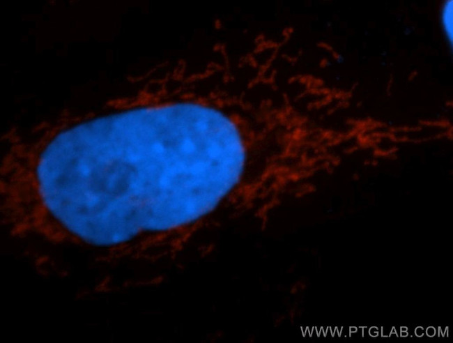 TIMM44 Antibody in Immunocytochemistry (ICC/IF)