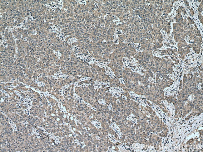 CCPG1 Antibody in Immunohistochemistry (Paraffin) (IHC (P))