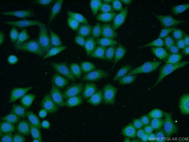 TACC1 Antibody in Immunocytochemistry (ICC/IF)