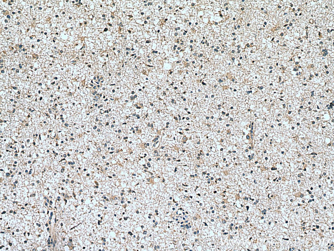 Frizzled 9 Antibody in Immunohistochemistry (Paraffin) (IHC (P))