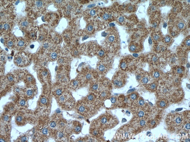 VPS41 Antibody in Immunohistochemistry (Paraffin) (IHC (P))