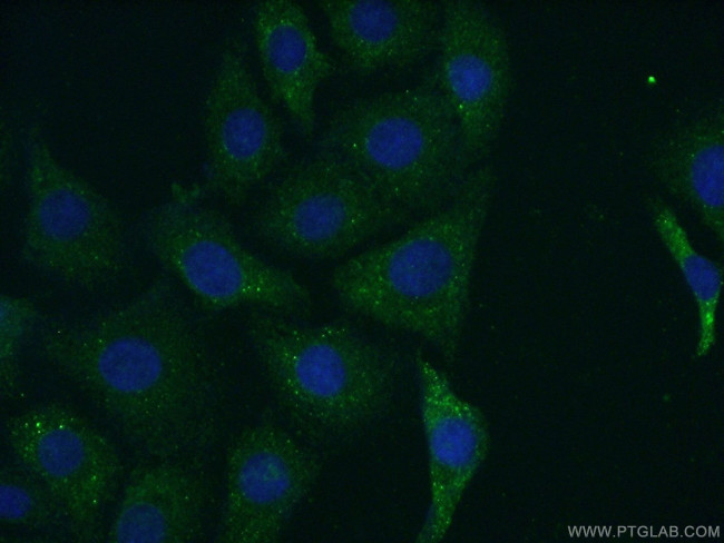DGKH Antibody in Immunocytochemistry (ICC/IF)