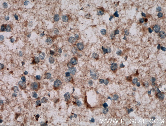 NKIAMRE Antibody in Immunohistochemistry (Paraffin) (IHC (P))