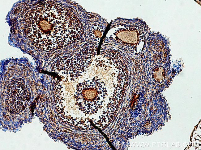 GREM2 Antibody in Immunohistochemistry (Paraffin) (IHC (P))