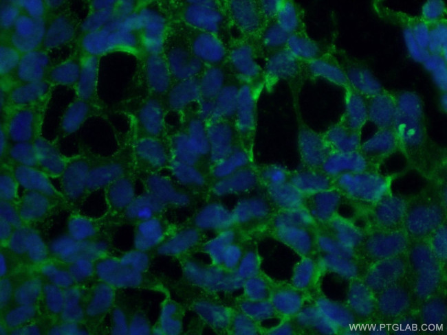 STARD8 Antibody in Immunocytochemistry (ICC/IF)