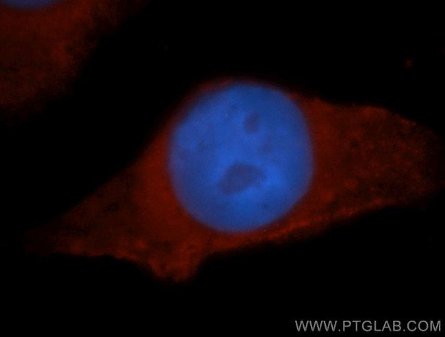 HPS5 Antibody in Immunocytochemistry (ICC/IF)
