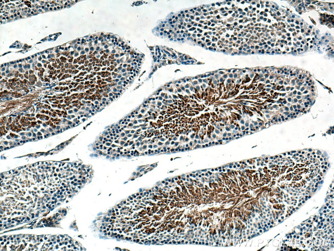 AKAP3 Antibody in Immunohistochemistry (Paraffin) (IHC (P))