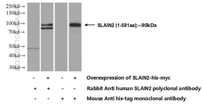SLAIN2 Antibody in Western Blot (WB)