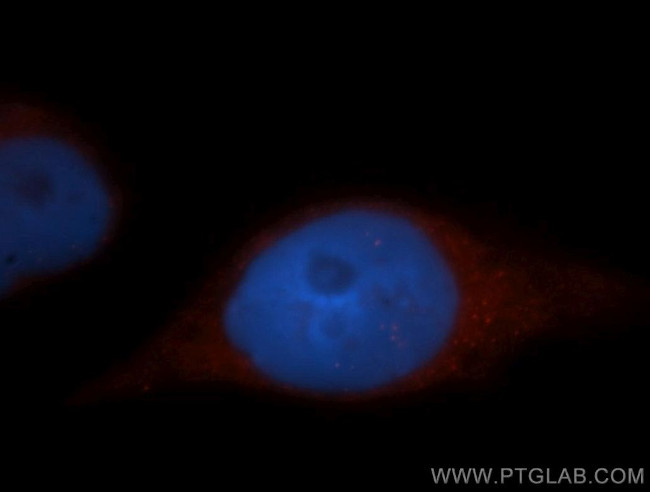 ADAP1 Antibody in Immunocytochemistry (ICC/IF)
