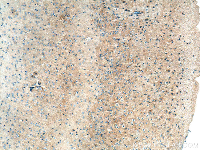 SLC6A11 Antibody in Immunohistochemistry (Paraffin) (IHC (P))