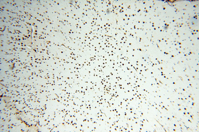 NKX2-5 Antibody in Immunohistochemistry (Paraffin) (IHC (P))