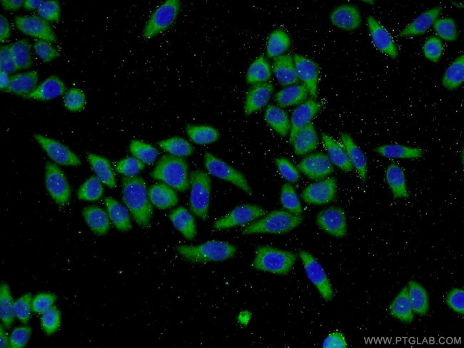 MTM1 Antibody in Immunocytochemistry (ICC/IF)