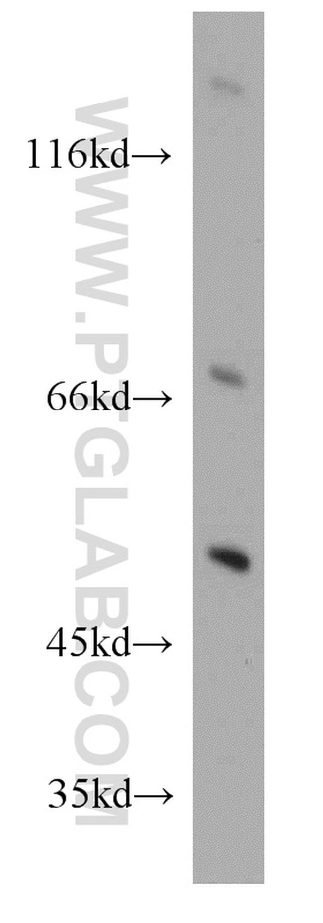 TSPYL1 Antibody in Western Blot (WB)