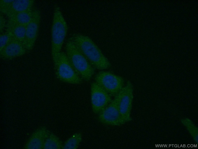FBXL14 Antibody in Immunocytochemistry (ICC/IF)