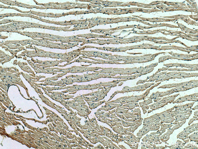 RHOBTB3 Antibody in Immunohistochemistry (Paraffin) (IHC (P))