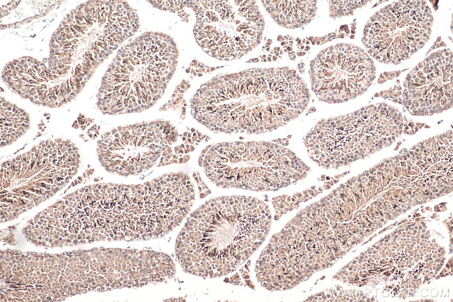 EMB Antibody in Immunohistochemistry (Paraffin) (IHC (P))