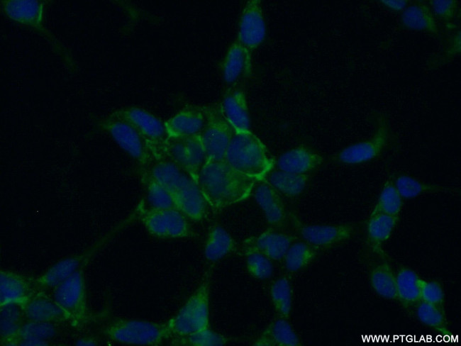 GPX3 Antibody in Immunocytochemistry (ICC/IF)