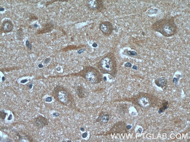 FAM19A5 Antibody in Immunohistochemistry (Paraffin) (IHC (P))