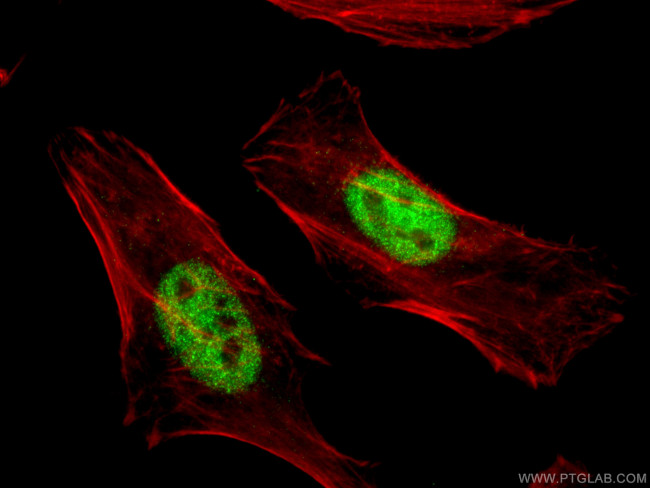 MAPKAPK2 Antibody in Immunocytochemistry (ICC/IF)