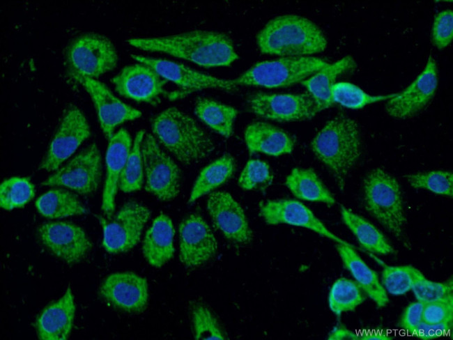 PPFIBP2 Antibody in Immunocytochemistry (ICC/IF)