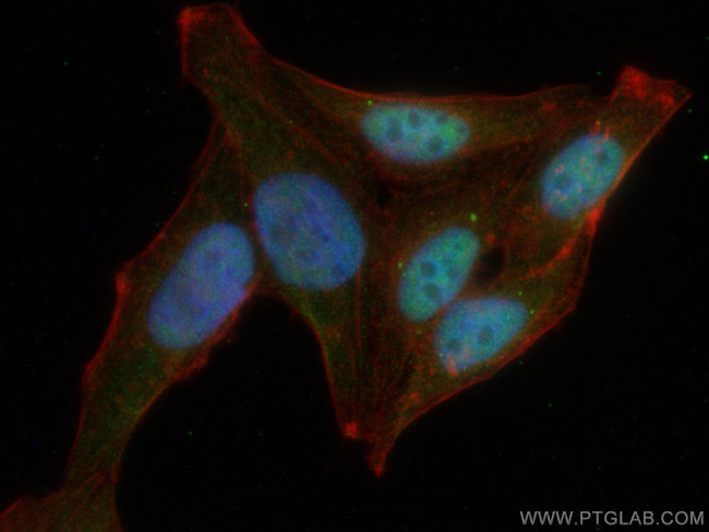 Chk2 Antibody in Immunocytochemistry (ICC/IF)