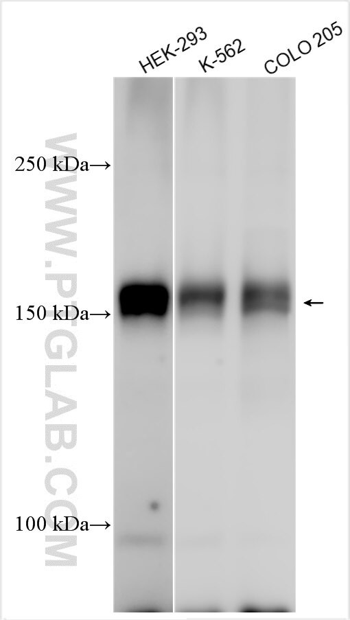 TNIK Antibody in Western Blot (WB)