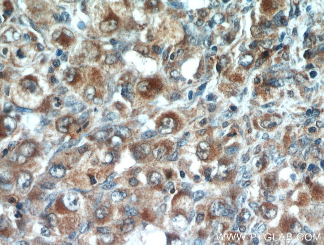 CD43 Antibody in Immunohistochemistry (Paraffin) (IHC (P))