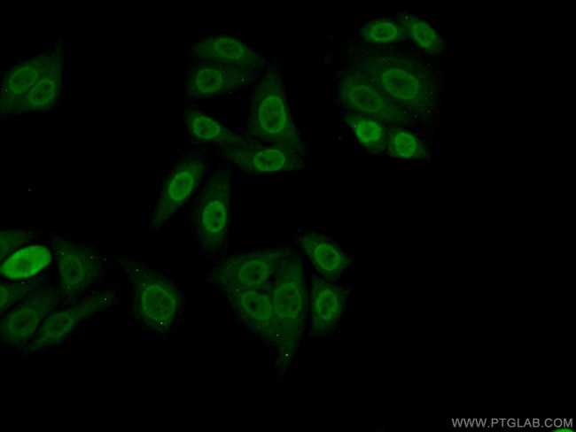 PPFIBP1 Antibody in Immunocytochemistry (ICC/IF)