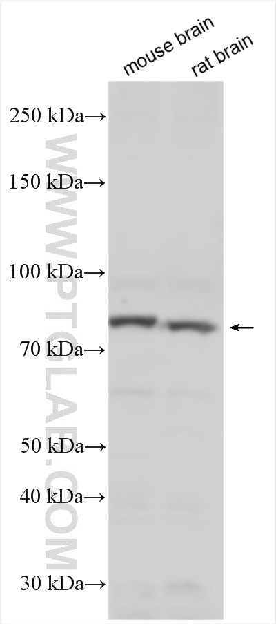 RFX4 Antibody in Western Blot (WB)