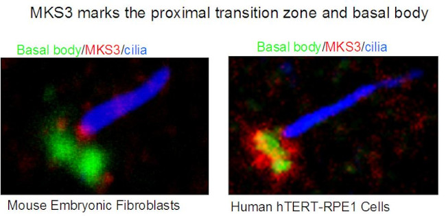 MKS3 Antibody in Immunocytochemistry (ICC/IF)