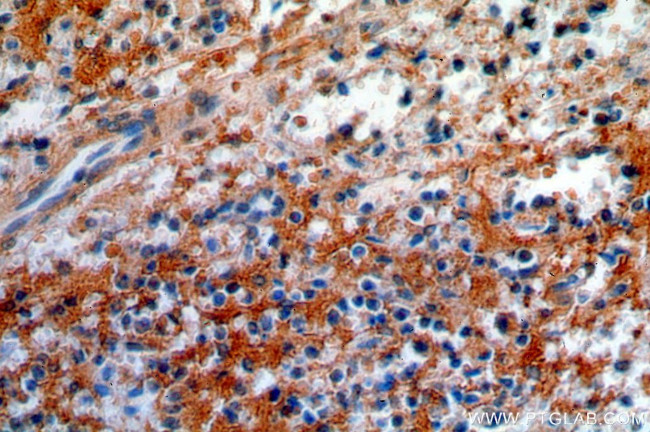CNNM3 Antibody in Immunohistochemistry (Paraffin) (IHC (P))