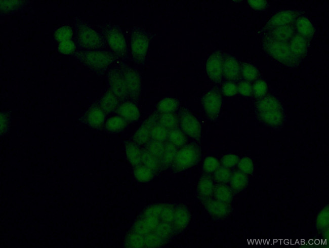 TLK2 Antibody in Immunocytochemistry (ICC/IF)