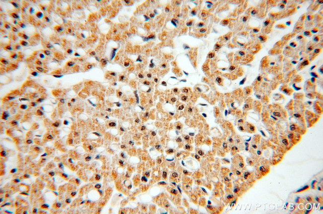 PCAF Antibody in Immunohistochemistry (Paraffin) (IHC (P))