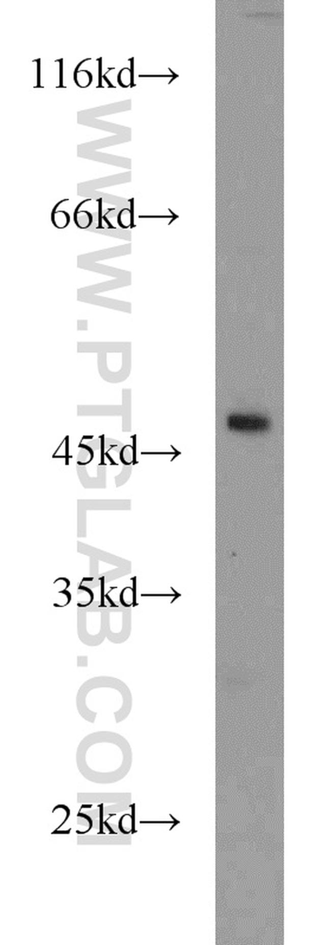 ANGPTL5 Antibody in Western Blot (WB)