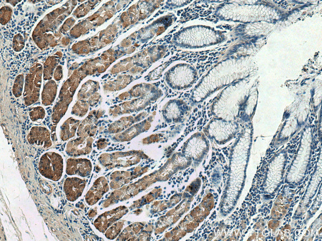 TRAK1 Antibody in Immunohistochemistry (Paraffin) (IHC (P))