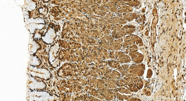 4EBP1 Antibody in Immunohistochemistry (Paraffin) (IHC (P))