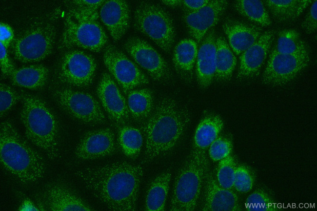 MTSS1 Antibody in Immunocytochemistry (ICC/IF)