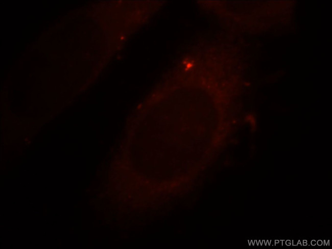 PARD6B Antibody in Immunocytochemistry (ICC/IF)