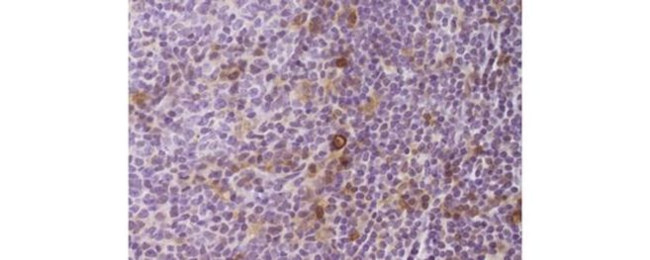 CD25 Antibody in Immunohistochemistry (Paraffin) (IHC (P))