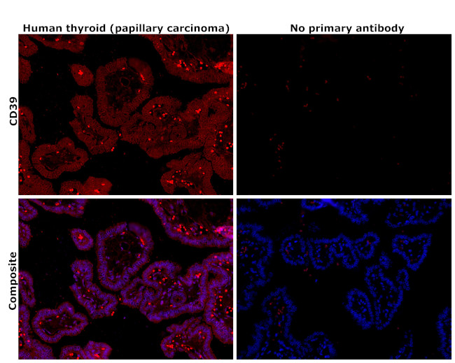 CD39 Antibody in Immunohistochemistry (Paraffin) (IHC (P))