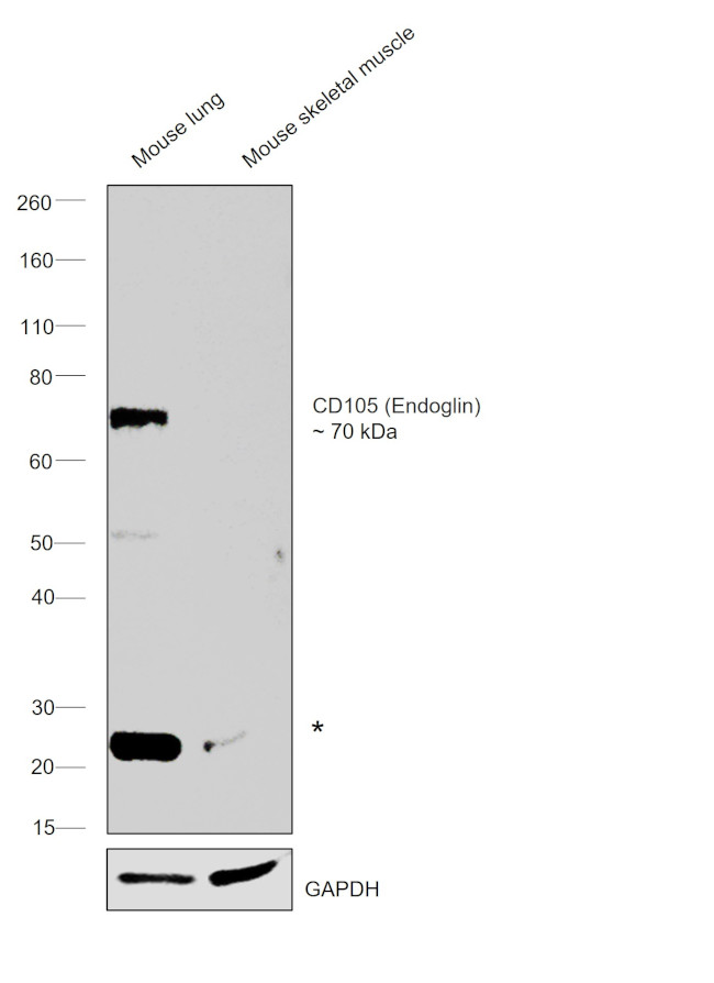 CD105 (Endoglin) Antibody in Western Blot (WB)
