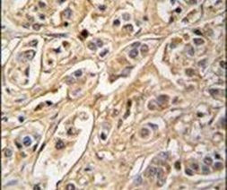 14-3-3 zeta Antibody in Immunohistochemistry (IHC)