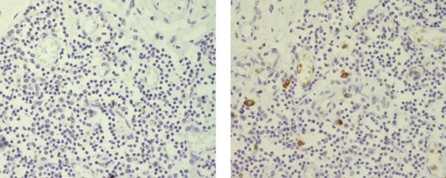 Rat IgG2b kappa Isotype Control in Immunohistochemistry (Paraffin) (IHC (P))