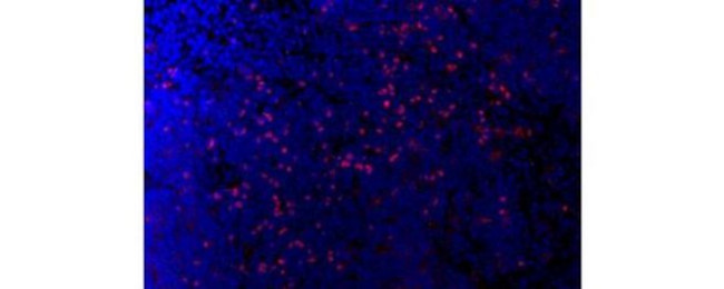 FOXP3 Antibody in Immunohistochemistry (Frozen) (IHC (F))