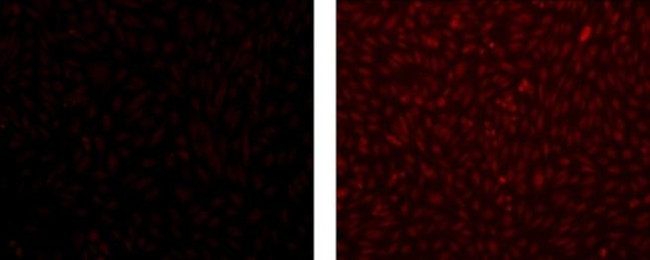 MASH1 Antibody in Immunocytochemistry (ICC/IF)