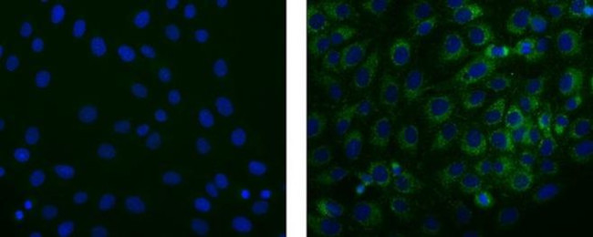 STRO-1 Antibody in Immunocytochemistry (ICC/IF)