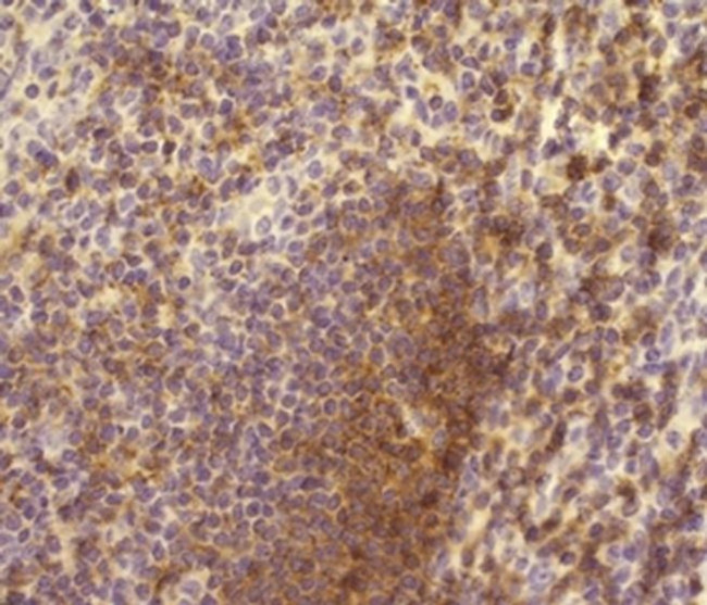 Phospho-BTK/ITK (Tyr551, Tyr511) Antibody in Immunohistochemistry (Paraffin) (IHC (P))